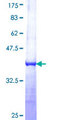 MORC1 Protein - 12.5% SDS-PAGE Stained with Coomassie Blue.