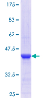 MORF4L1 / MRG15 Protein - 12.5% SDS-PAGE Stained with Coomassie Blue.