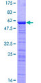 MORF4L2 / MRGX Protein - 12.5% SDS-PAGE of human MORF4L2 stained with Coomassie Blue