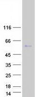 MORN1 Protein - Purified recombinant protein MORN1 was analyzed by SDS-PAGE gel and Coomassie Blue Staining