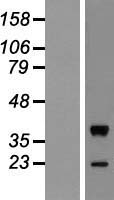 MOS Protein - Western validation with an anti-DDK antibody * L: Control HEK293 lysate R: Over-expression lysate