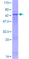 MOS Protein - 12.5% SDS-PAGE of human MOS stained with Coomassie Blue