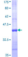 MOS Protein - 12.5% SDS-PAGE Stained with Coomassie Blue.