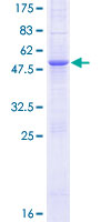 MOSPD1 Protein - 12.5% SDS-PAGE of human MOSPD1 stained with Coomassie Blue