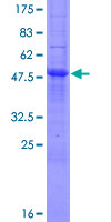 MOSPD3 Protein - 12.5% SDS-PAGE of human MOSPD3 stained with Coomassie Blue