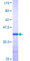 MOSPD3 Protein - 12.5% SDS-PAGE Stained with Coomassie Blue.