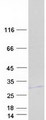 MOSPD3 Protein - Purified recombinant protein MOSPD3 was analyzed by SDS-PAGE gel and Coomassie Blue Staining