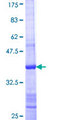 MOV10L1 Protein - 12.5% SDS-PAGE Stained with Coomassie Blue.