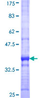 MOX / MOXD1 Protein - 12.5% SDS-PAGE Stained with Coomassie Blue.