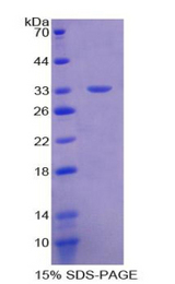 MPEG1 Protein - Recombinant Macrophage Expressed Protein 1 By SDS-PAGE
