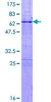 MPG Protein - 12.5% SDS-PAGE of human MPG stained with Coomassie Blue