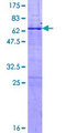 MPG Protein - 12.5% SDS-PAGE of human MPG stained with Coomassie Blue