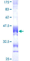 MPG Protein - 12.5% SDS-PAGE Stained with Coomassie Blue.