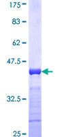 MPHOSPH10 / MPP10 Protein - 12.5% SDS-PAGE Stained with Coomassie Blue.