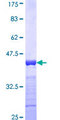 MPHOSPH10 / MPP10 Protein - 12.5% SDS-PAGE Stained with Coomassie Blue.