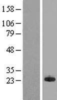MPHOSPH6 Protein - Western validation with an anti-DDK antibody * L: Control HEK293 lysate R: Over-expression lysate