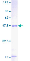MPHOSPH6 Protein - 12.5% SDS-PAGE of human MPHOSPH6 stained with Coomassie Blue
