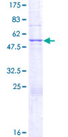MPHOSPH8 Protein - 12.5% SDS-PAGE of human MPHOSPH8 stained with Coomassie Blue