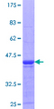 MPHOSPH8 Protein - 12.5% SDS-PAGE Stained with Coomassie Blue.