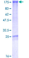 MPHOSPH9 Protein - 12.5% SDS-PAGE of human MPHOSPH9 stained with Coomassie Blue