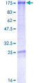 MPHOSPH9 Protein - 12.5% SDS-PAGE of human MPHOSPH9 stained with Coomassie Blue