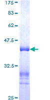 MPHOSPH9 Protein - 12.5% SDS-PAGE Stained with Coomassie Blue.