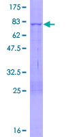 MPND Protein - 12.5% SDS-PAGE of human FLJ14981 stained with Coomassie Blue