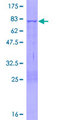 MPND Protein - 12.5% SDS-PAGE of human FLJ14981 stained with Coomassie Blue