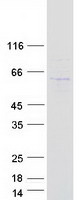 MPND Protein - Purified recombinant protein MPND was analyzed by SDS-PAGE gel and Coomassie Blue Staining