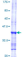 MPO / Myeloperoxidase Protein - 12.5% SDS-PAGE Stained with Coomassie Blue.