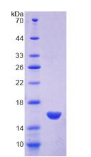 MPO / Myeloperoxidase Protein - Recombinant Myeloperoxidase By SDS-PAGE