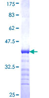MPP1 Protein - 12.5% SDS-PAGE Stained with Coomassie Blue.