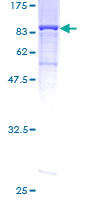 MPP2 Protein - 12.5% SDS-PAGE of human MPP2 stained with Coomassie Blue