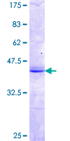 MPP2 Protein - 12.5% SDS-PAGE Stained with Coomassie Blue.