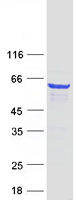 MPP2 Protein - Purified recombinant protein MPP2 was analyzed by SDS-PAGE gel and Coomassie Blue Staining