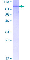 MPP3 Protein - 12.5% SDS-PAGE of human MPP3 stained with Coomassie Blue