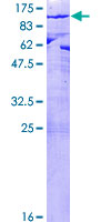 MPP5 Protein - 12.5% SDS-PAGE of human MPP5 stained with Coomassie Blue
