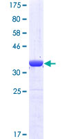 MPP5 Protein - 12.5% SDS-PAGE Stained with Coomassie Blue.