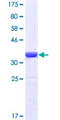 MPP5 Protein - 12.5% SDS-PAGE Stained with Coomassie Blue.