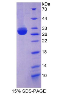 MPP5 Protein - Recombinant Membrane Protein, Palmitoylated 5 By SDS-PAGE