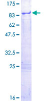 MPP7 Protein - 12.5% SDS-PAGE of human MPP7 stained with Coomassie Blue