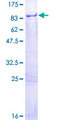 MPP7 Protein - 12.5% SDS-PAGE of human MPP7 stained with Coomassie Blue