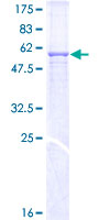 MPPE1 / PGAP5 Protein - 12.5% SDS-PAGE of human MPPE1 stained with Coomassie Blue