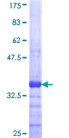 MPPED1 Protein - 12.5% SDS-PAGE Stained with Coomassie Blue.