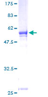 MPPED2 Protein - 12.5% SDS-PAGE of human MPPED2 stained with Coomassie Blue