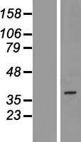 MPRG / PAQR5 Protein - Western validation with an anti-DDK antibody * L: Control HEK293 lysate R: Over-expression lysate