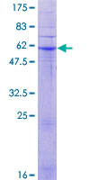 MPRG / PAQR5 Protein - 12.5% SDS-PAGE of human PAQR5 stained with Coomassie Blue