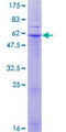 MPRG / PAQR5 Protein - 12.5% SDS-PAGE of human PAQR5 stained with Coomassie Blue