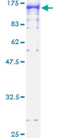 MPS1 / TTK Protein - 12.5% SDS-PAGE of human TTK stained with Coomassie Blue