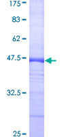 MPS1 / TTK Protein - 12.5% SDS-PAGE Stained with Coomassie Blue.